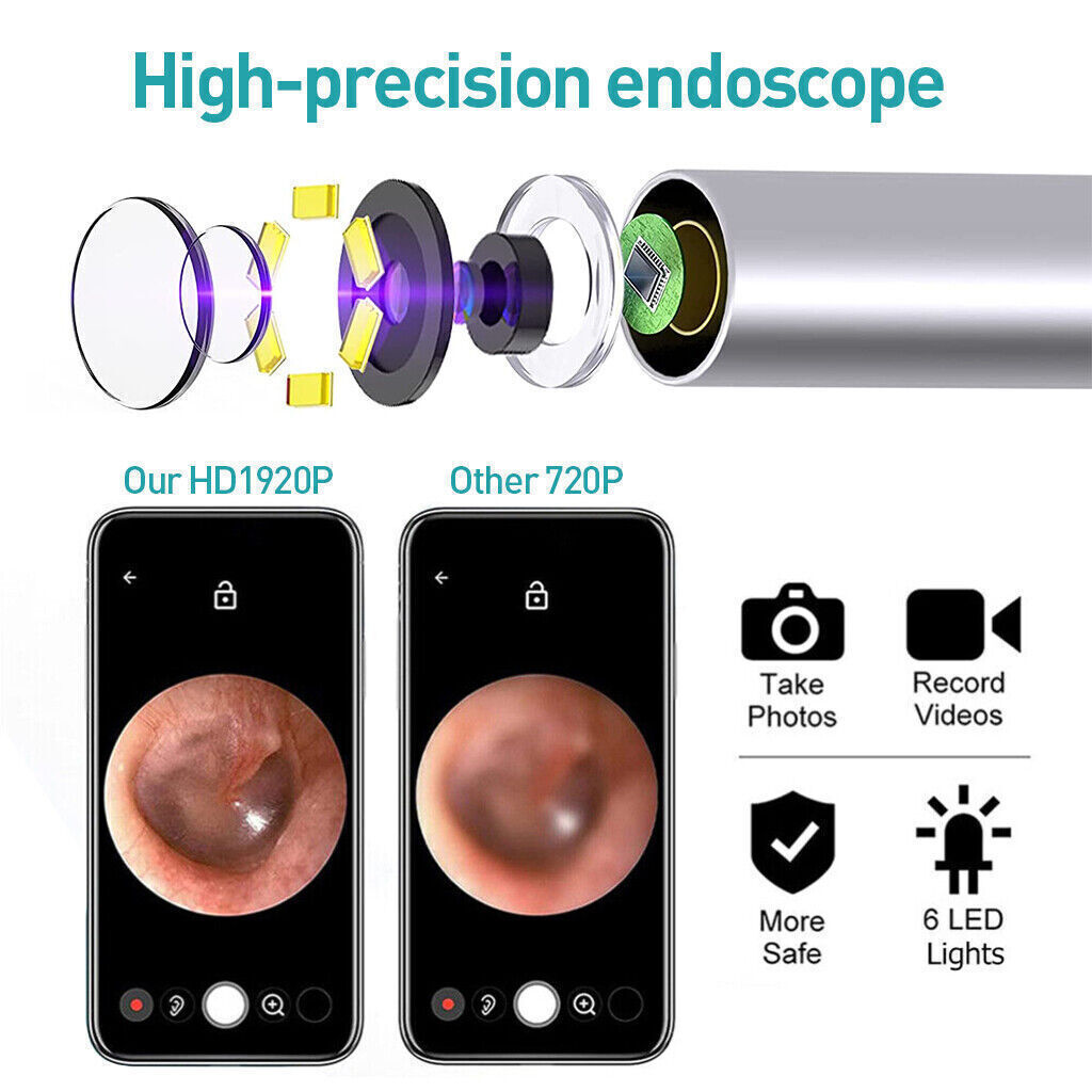 Smart Ear Cleaning Kit with Camera